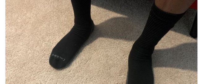 Amputation rates higher for people with PAD who are poor or Black; other health gaps noted in special issue